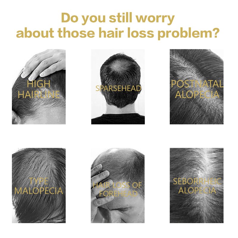 Black Women Hair Serum - Manufacturer - Organic Smoothing Scalp Care Nourishing Anti-Loss Regrowth