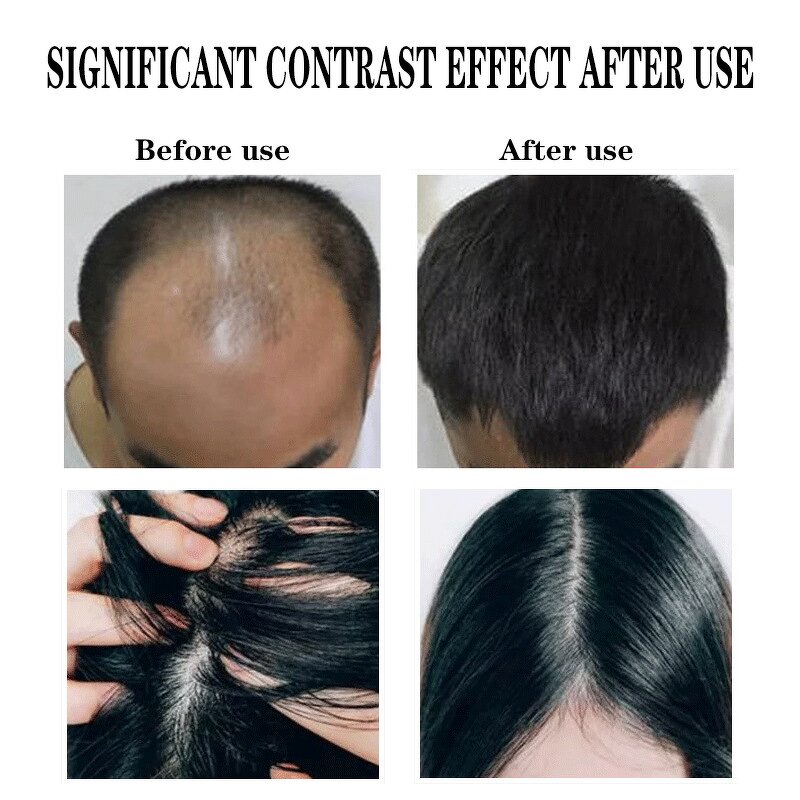 Hair Regrowth Serum - Manufacturer - Private Label Restoration Baldness Thinning Hair Fall Repair
