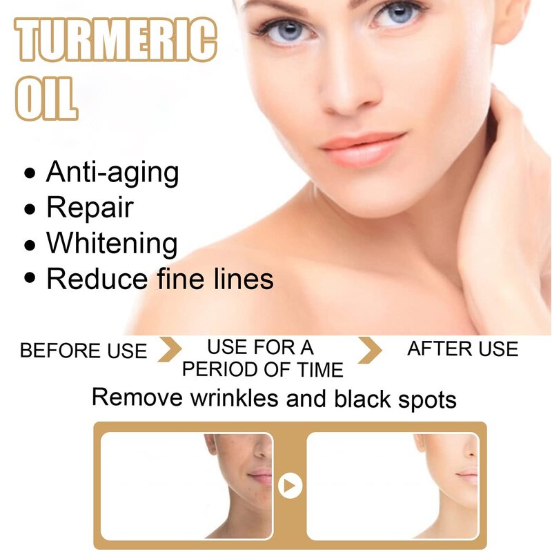 Turmeric Face Oil - Manufacturer - Natural Moisture Dark Spot Corrector Anti Acne Whitening