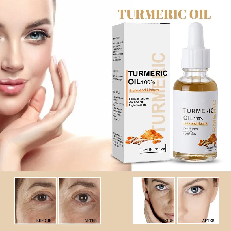 Turmeric Face Oil - Manufacturer - Natural Moisture Dark Spot Corrector Anti Acne Whitening