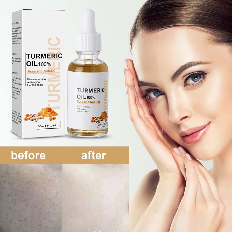 Turmeric Face Oil - Manufacturer - Natural Moisture Dark Spot Corrector Anti Acne Whitening