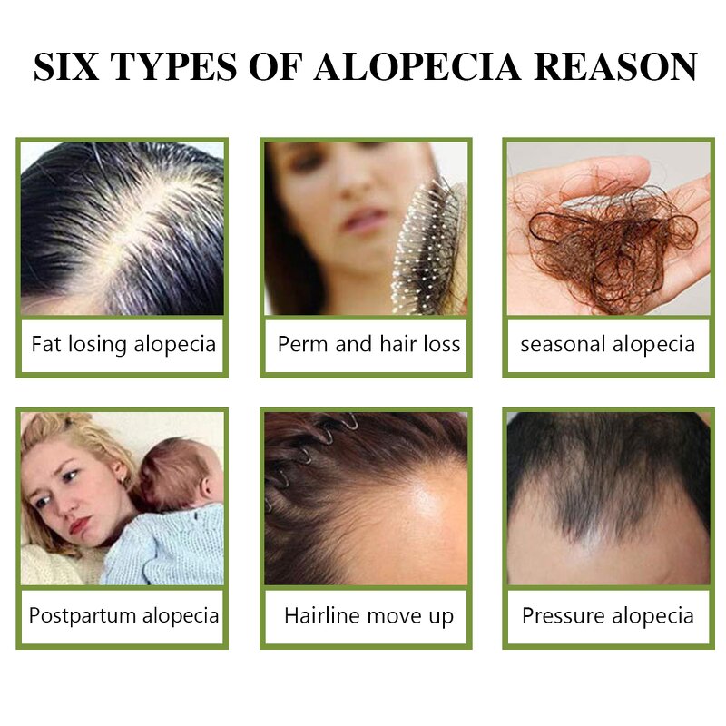 Scalp Care Hair Serum - Manufacturer - Private Label Best Repair Moisturized Anti Hair Loss Growth