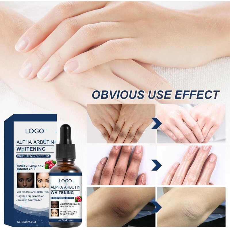 Alpha Arbutin Serum - Manufacturer - Private Label Niacinamide Whitening Dark Spot Anti Wrinkle