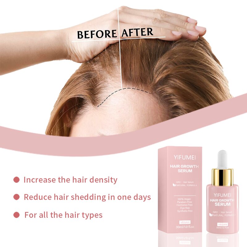 Rosemary Hair Growth Serum - Manufacturer - Private Label Organic Anti Loss Regrowth Repair Oil