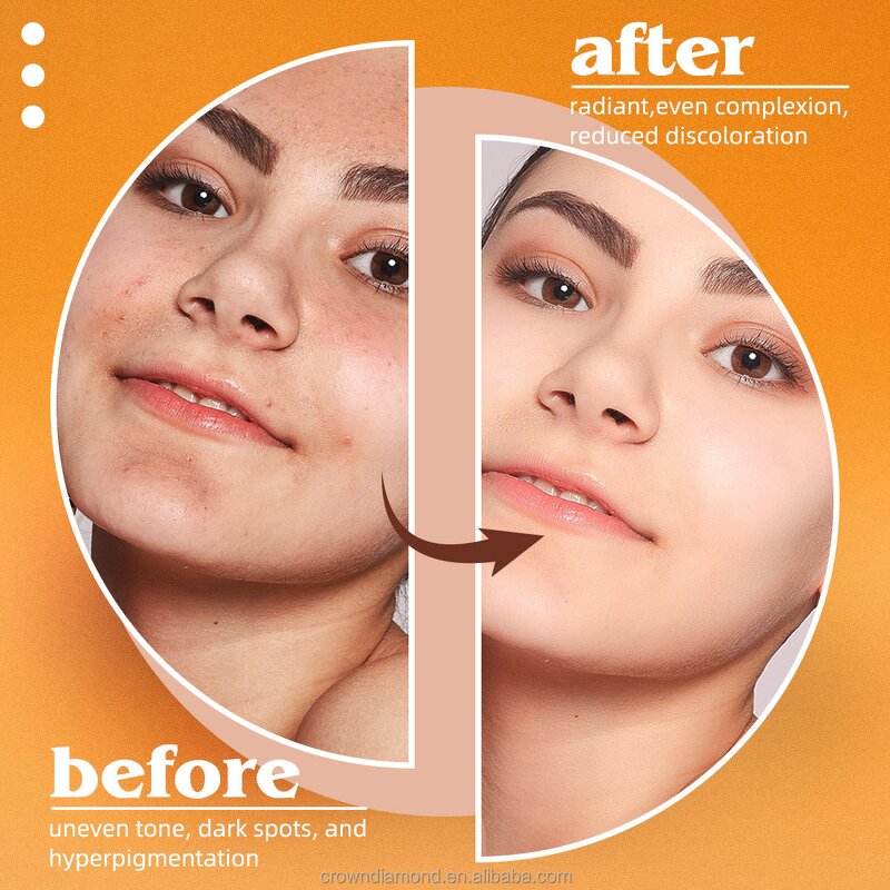 Kojic Acid Soap - Manufacturer - Wholesale Natural Turmeric Dark Spot Corrector Skin Whitening