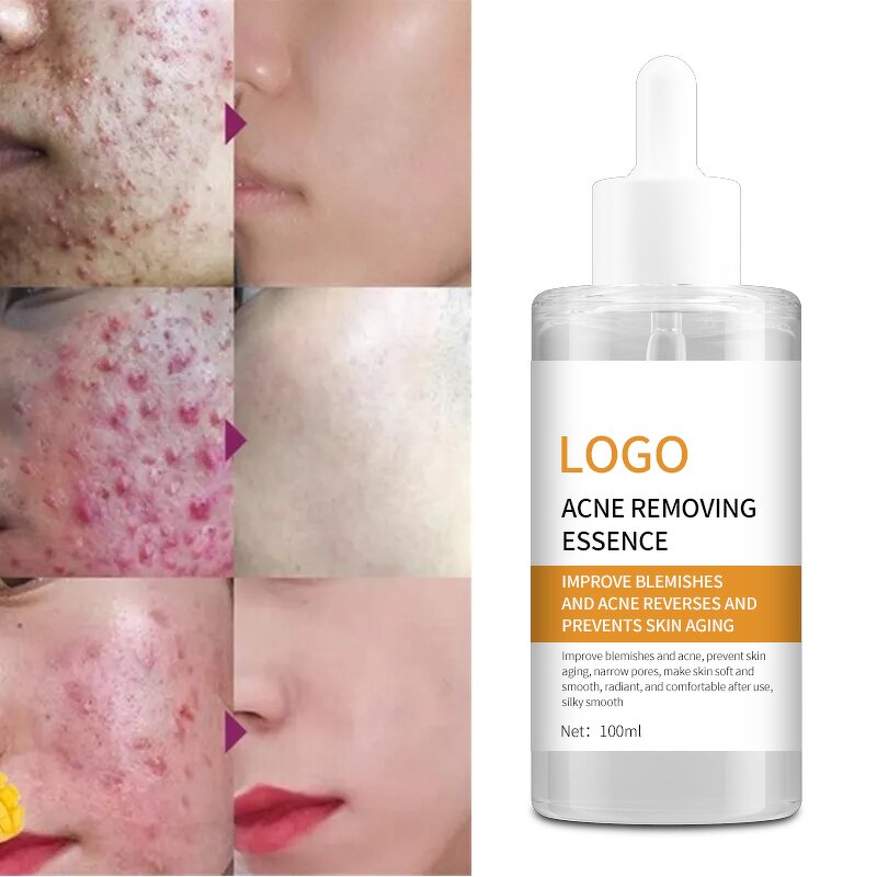 Salicylic Acid Serum - Manufacturer - Private Label Lightening Dark Spot Whitening Anti Acne Exfoliating