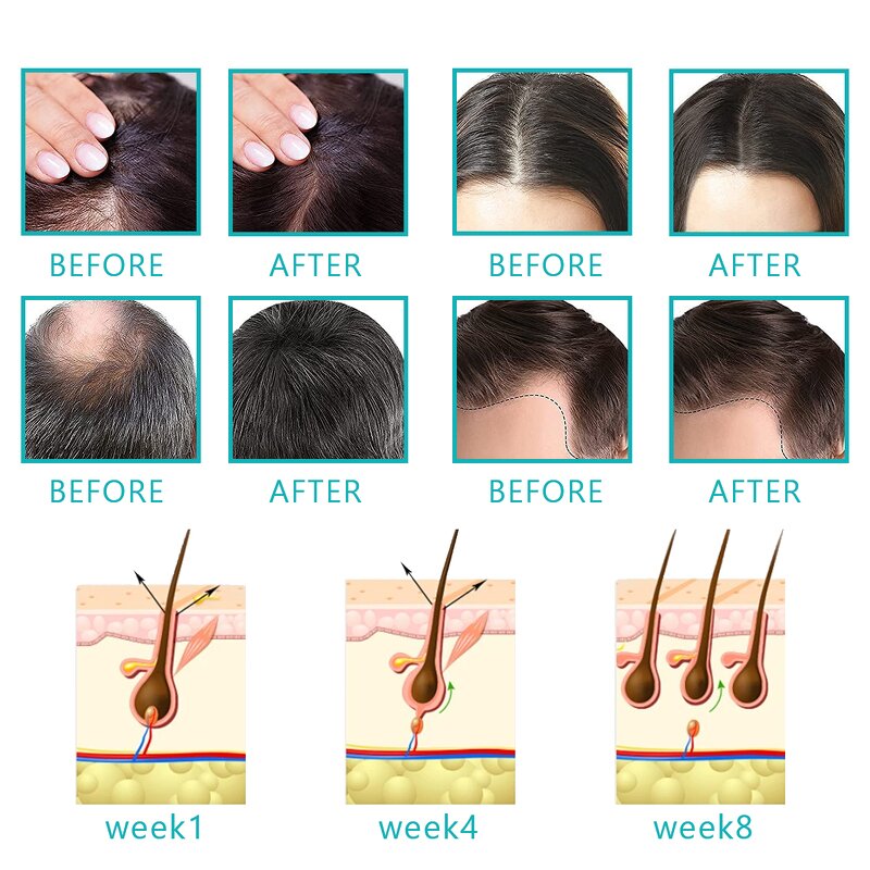 Hair Growth Essential Oil - Manufacturer - Organic Nourishing Anti Frizz Scalp Care Regrowth Treatment