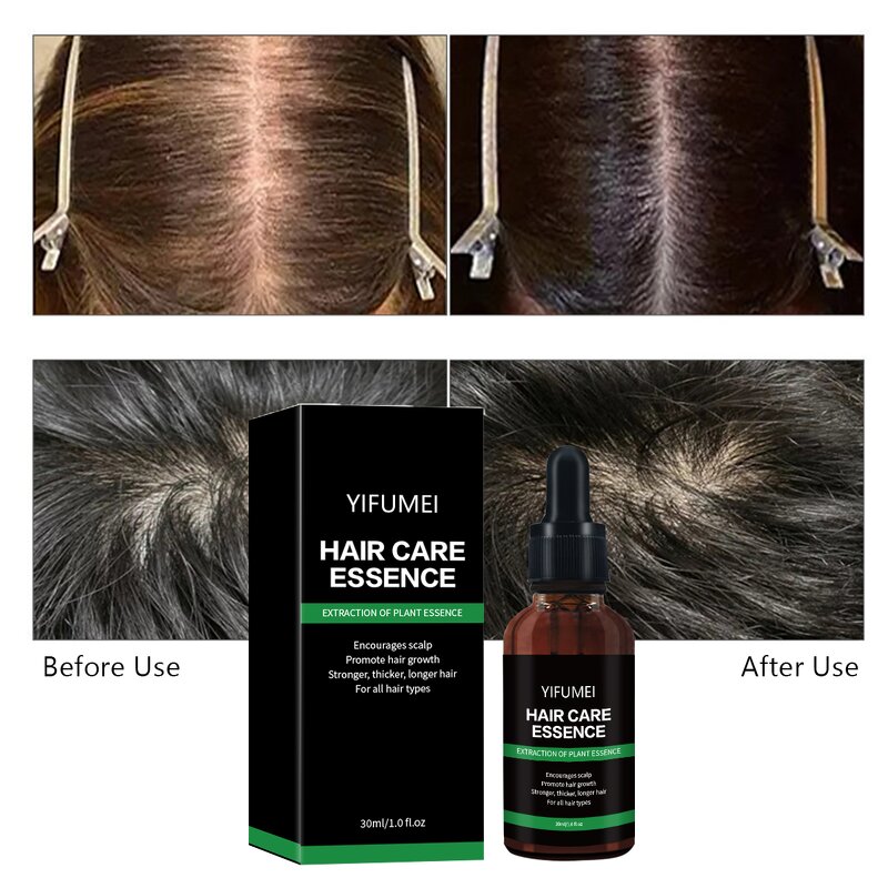 Ginger Hair Growth Serum - Manufacturer - Private Label Natural Organic Anti-Loss Regrowth Scalp Care