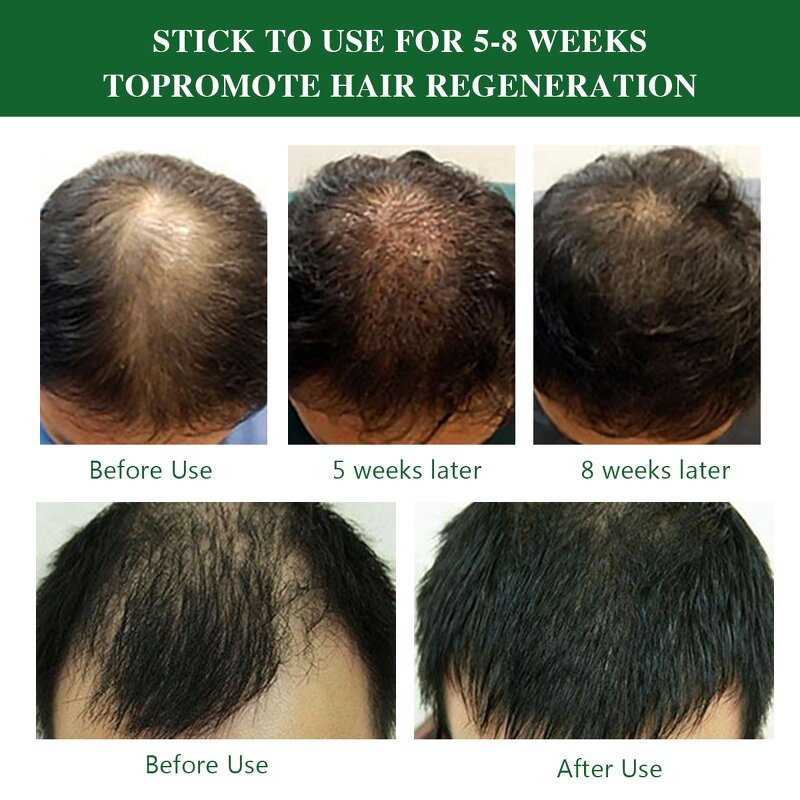 Ginger Hair Growth Serum - Manufacturer - Private Label Natural Organic Anti-Loss Regrowth Scalp Care