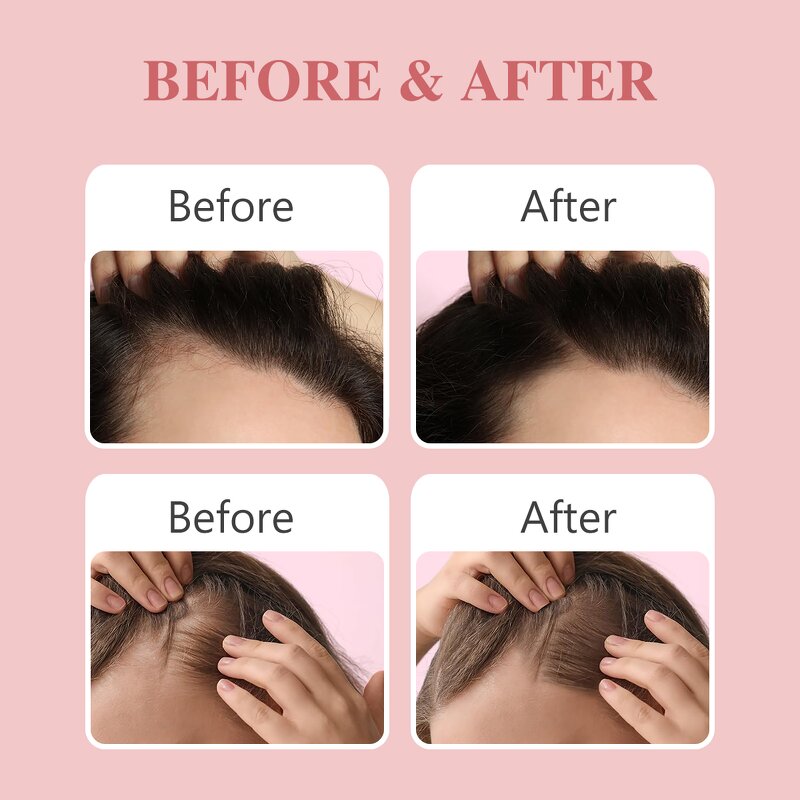 Rosemary Hair Oil - Manufacturer - Private Label Anti Loss Regrowth Hair Growth Treatments Serum