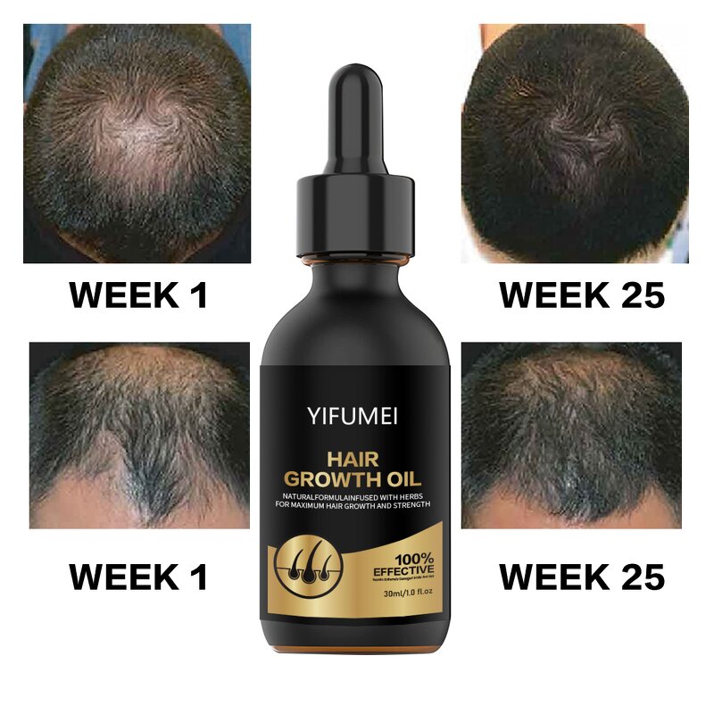Biotin Hair Growth Serum - Manufacturer - Private Label 100% Effective Anti Loss Repair Regrowth