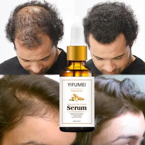 Ginseng Hair Growth Oil - Manufacturer - Private Label Natural Organic Anti-Loss Regrowth Serum