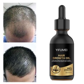 Biotin Hair Growth Serum - Manufacturer - Private Label 100% Effective Anti Loss Repair Regrowth