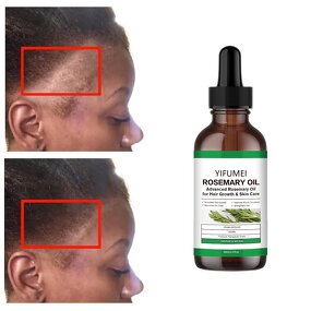 Rosemary Hair Oil - Manufacturer - Private Label Wholesale Anti-Loss Regrowth Treatment Repair Serum