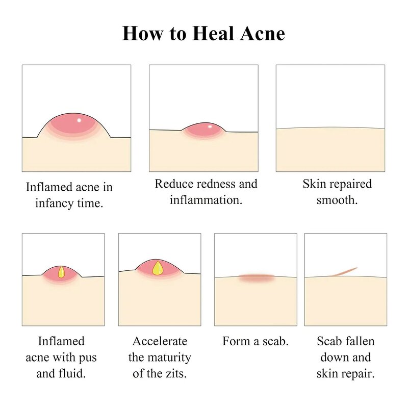 Salicylic Acid Serum - Manufacturer - Private Label Lightening Dark Spot Whitening Anti Acne Exfoliating