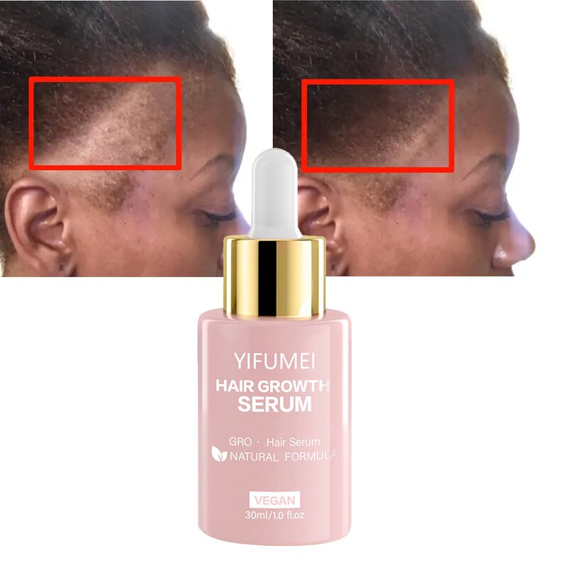 Rosemary Hair Growth Serum - Manufacturer - Private Label Organic Anti Loss Regrowth Repair Oil