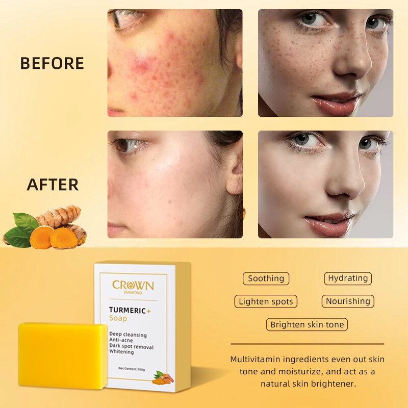 Turmeric Soap - Manufacturer - Wholesale Organic Handmade Deep Cleansing Anti Acne Lightening