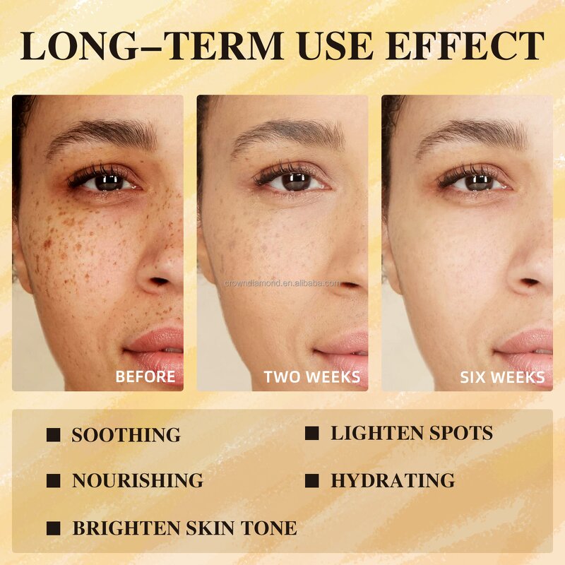 Turmeric Skincare Set - Manufacturer - Private Label Natural Anti Ageing Acne Lightening Whitening