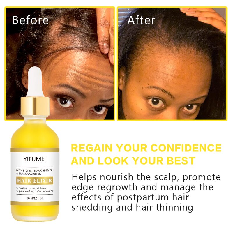 Biotin Hair Growth Serum - Manufacturer - Private Label Organic Anti Loss Scalprepair Regrowth Supplement