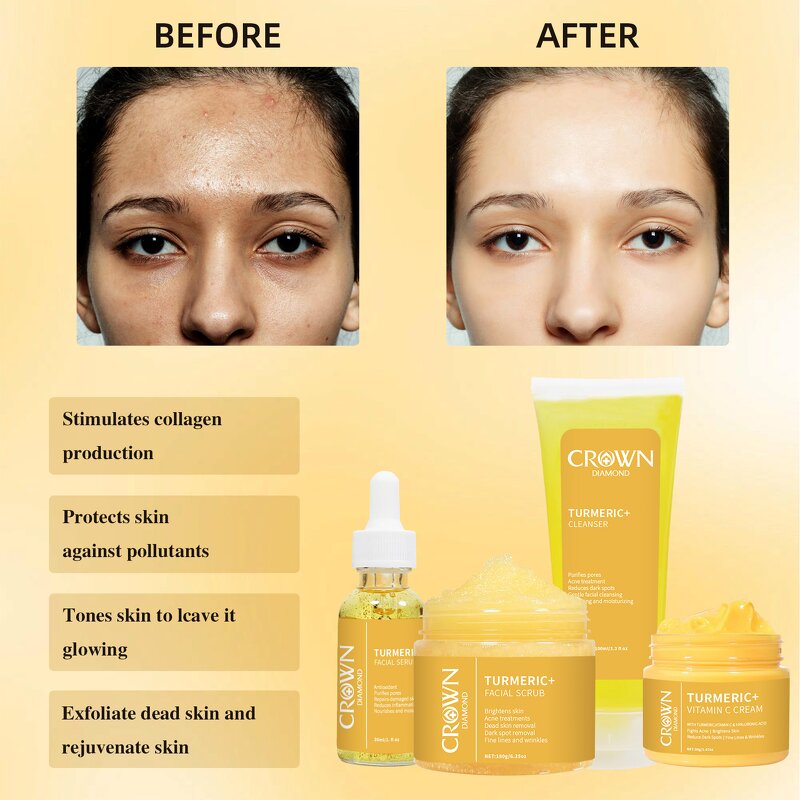 Turmeric Skincare Set - Manufacturer - Private Label Natural Anti Ageing Acne Lightening Whitening