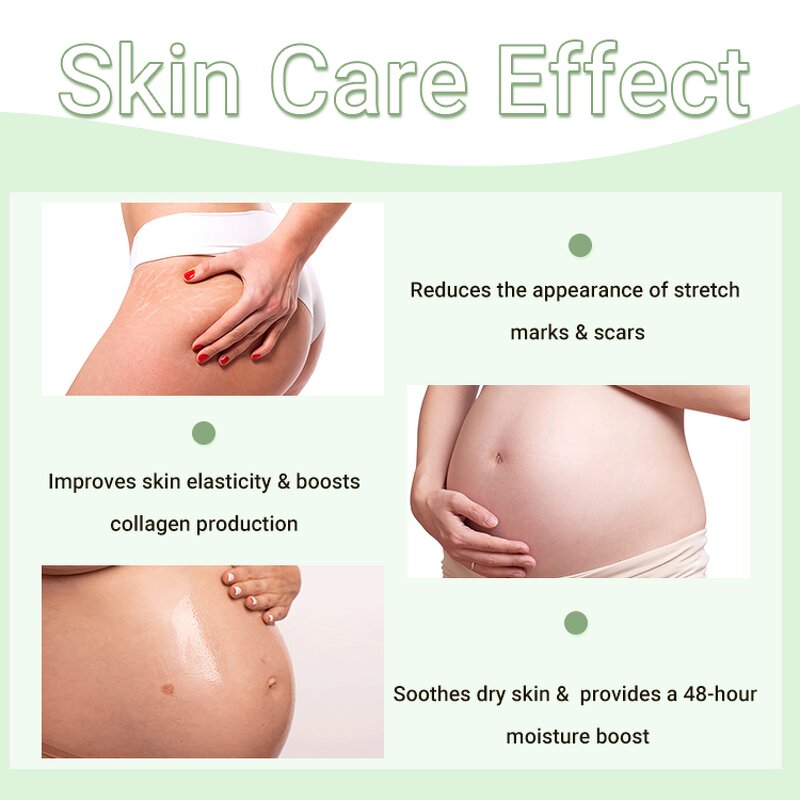 Stretch Marks Oil Manufacturer - Whitens Naturally for Scars & Marks