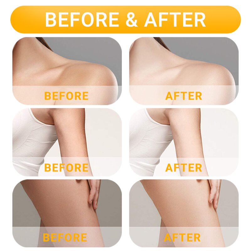 Body Massage Oil Manufacturer - Best Skin Lemon Lightening 150ml Organic