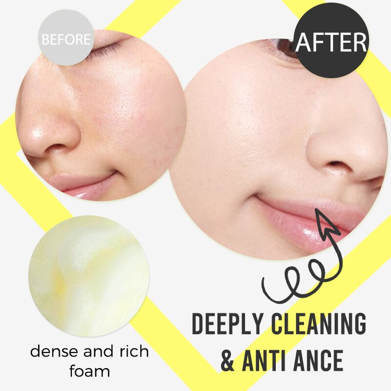 Facial Foam Manufacturer - Private Label OEM Dark Spots Removal Turmeric Lemon