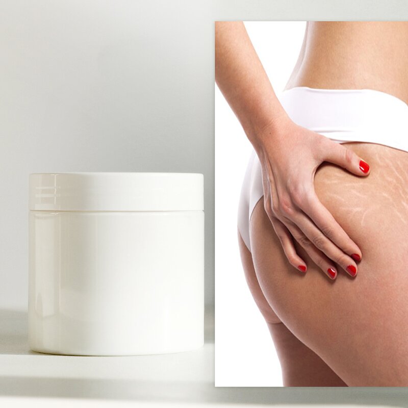 Stretch Mark Cream Manufacturer - Private Label for Pregnancy Anti Mark