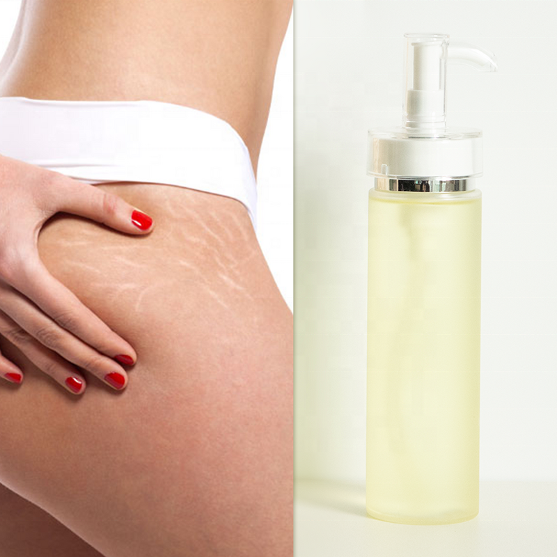 Body Lotion Manufacturer - Private Label Repairing for Anti-Body Stretch Mark