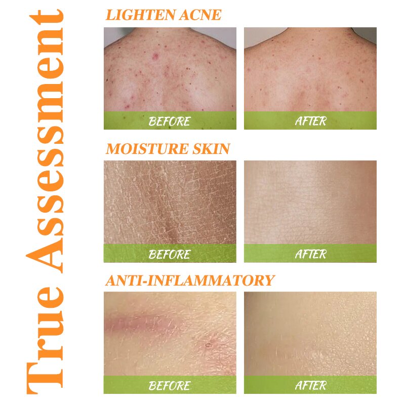 Body Lotion Manufacturer - Natural Dry Skin with Glycerin Turmeric Whitening