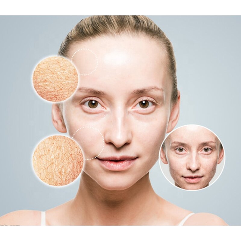 Face Cream Manufacturer - Hot Selling Private Label for Black Skin Brightening