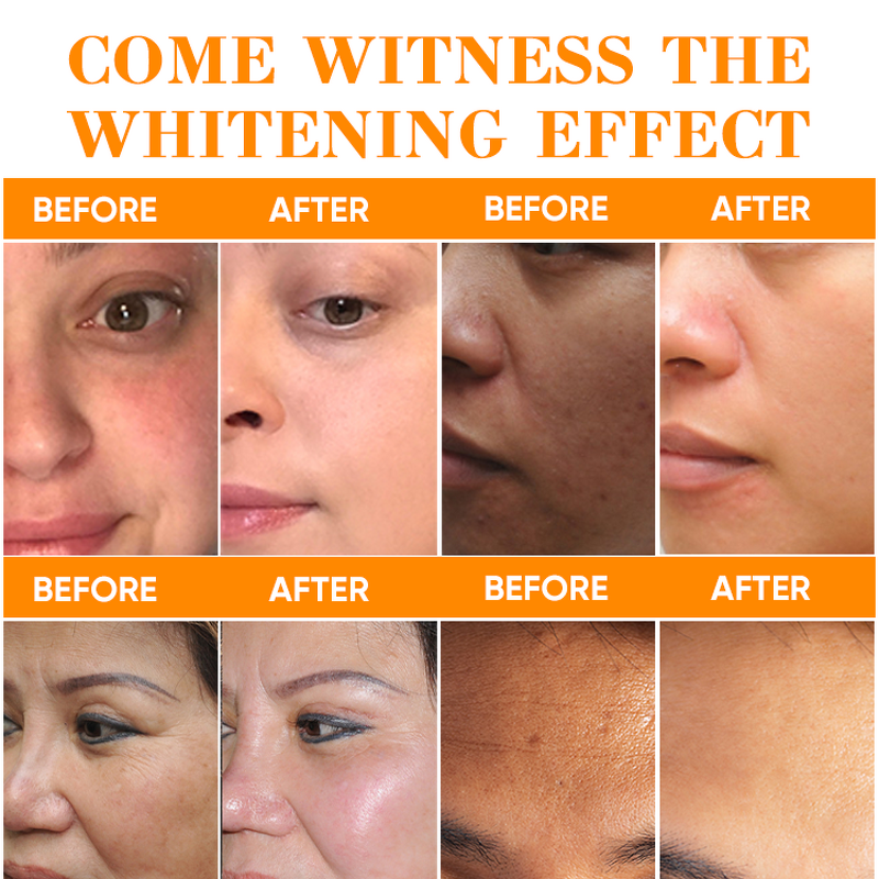 Skin Care Set Manufacturer - Private Label Organic Papaya Whitening Fast Bleaching