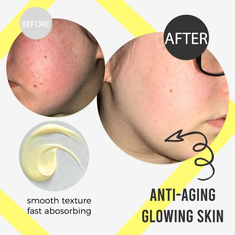 Face Cream Manufacturer - Natural Gallon Turmeric Lemon Whitening & Anti Aging