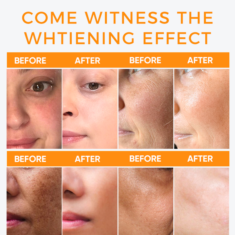 Face Cream Manufacturer - Private Label Organic Papaya Whitening with Glycerin