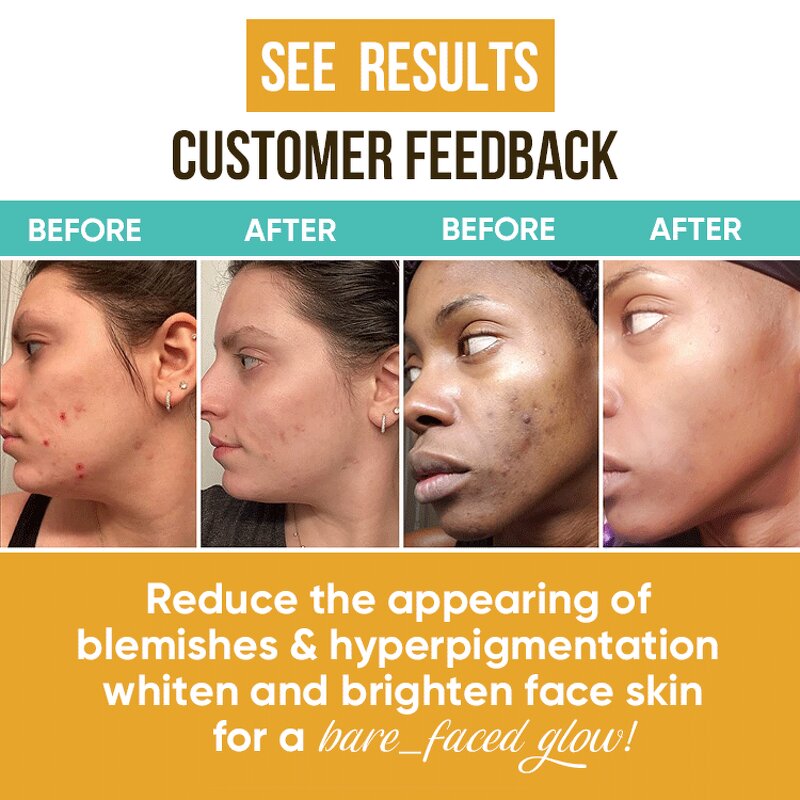 Cosmetic Set Manufacturer - High Class Whitening with Turmeric Soap, Serum & Lotion