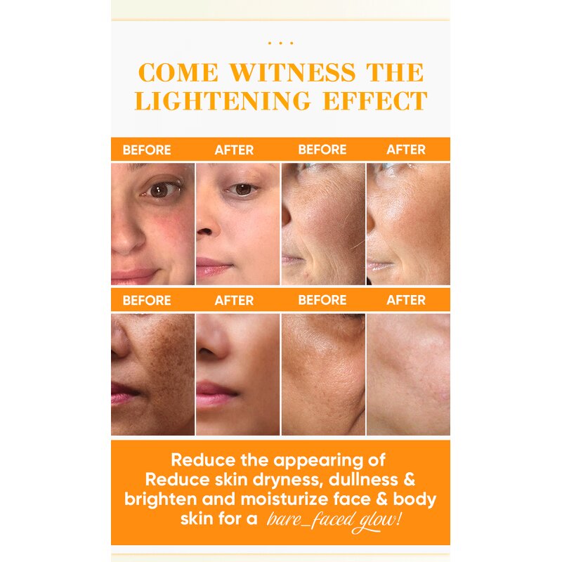 Skincare Set Manufacturer - Natural Organic Lemon with Cream, Lotion, Oil & Soap