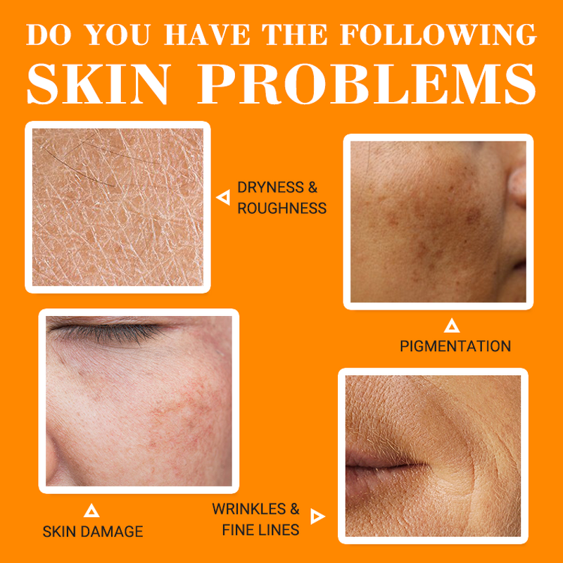 Face Cream Manufacturer - Popular Lemon Papaya Fast Whitening & Moisturizing