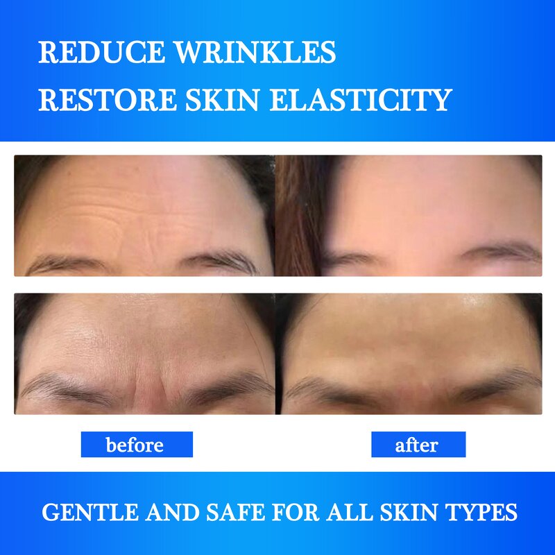 Wrinkle Remover Patches - Manufacturer - OEM Custom Logo Collagen Forehead Instant Strips
