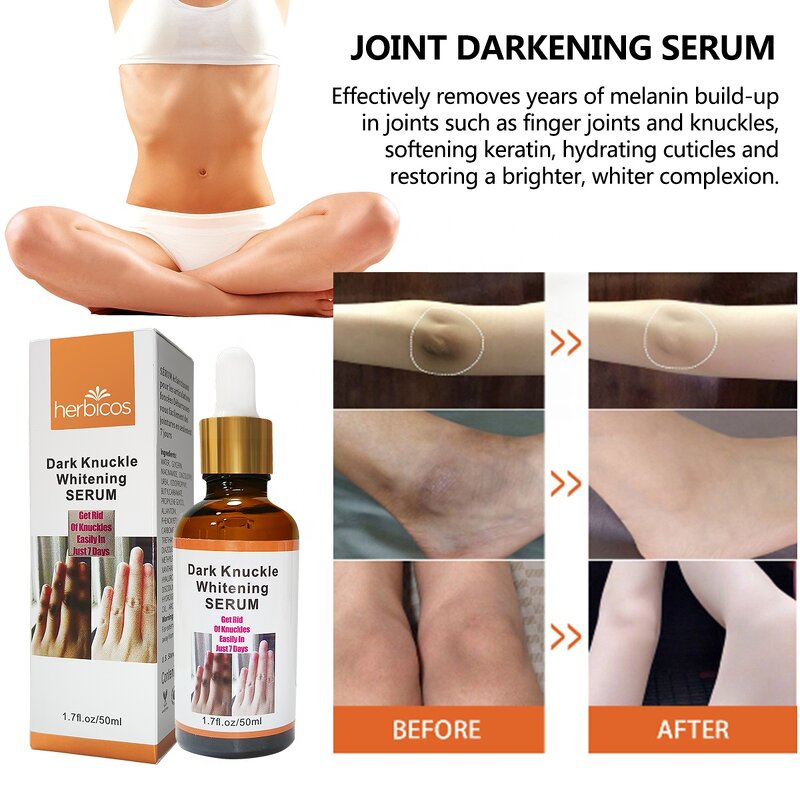 Dark Knuckle Serum - Manufacturer - OEM ODM Factory 7 Days Fast Whitening Spot Remover