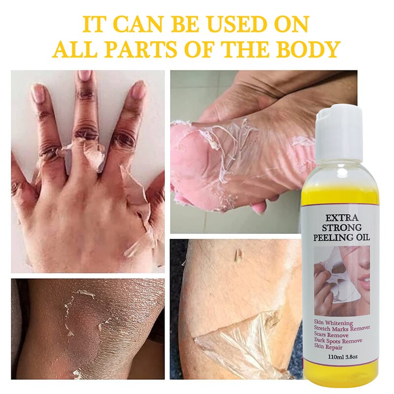 Yellow Peeling Oil - Manufacturer - Private Label Extra Strength Body Exfoliating Dark Skin