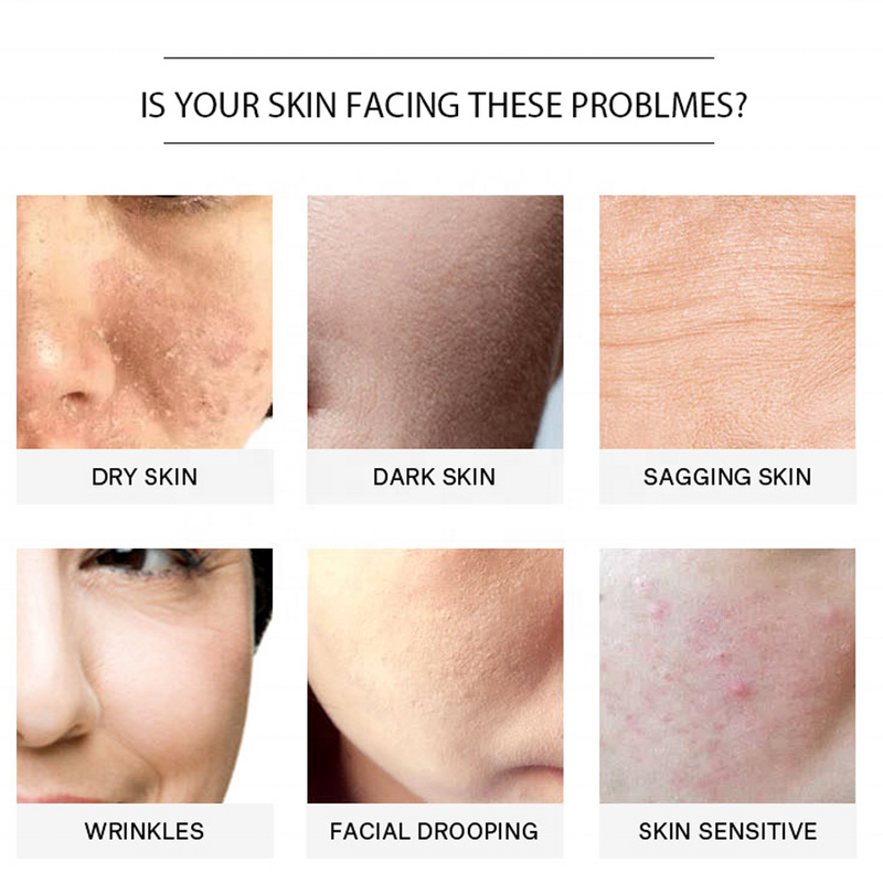 Coffee Body Scrub - Manufacturer - Natural Organic Coconut Shea Butter Acne Stretch Marks