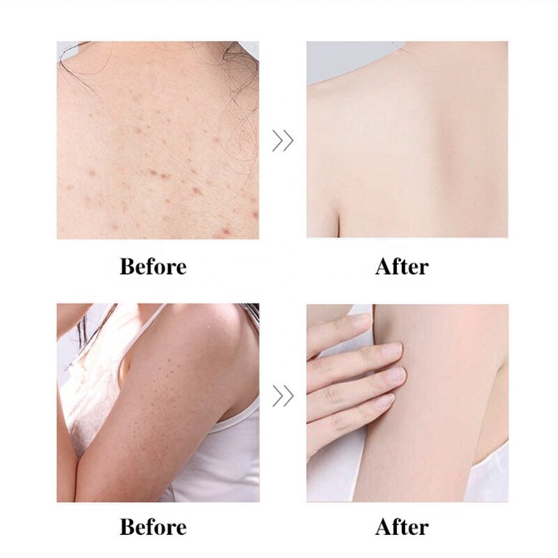 Watermelon Body Scrub - Manufacturer - Women's Pink Vitamin C Exfoliating Nourishing Skincare