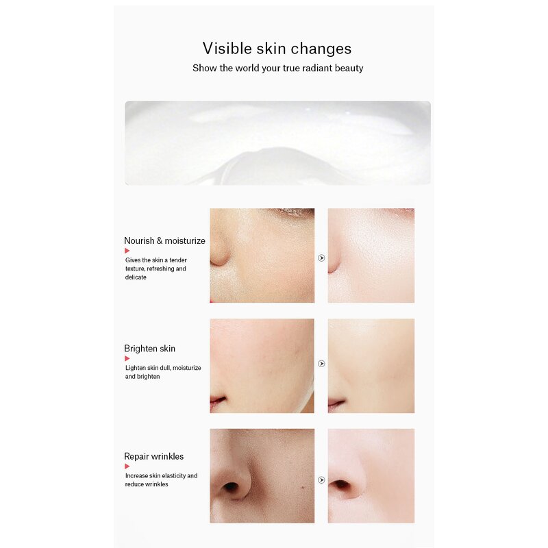 Basic Skin Care Set - Manufacturer - Oem Anti Acne Face Whitening Acne Prone Skin Care