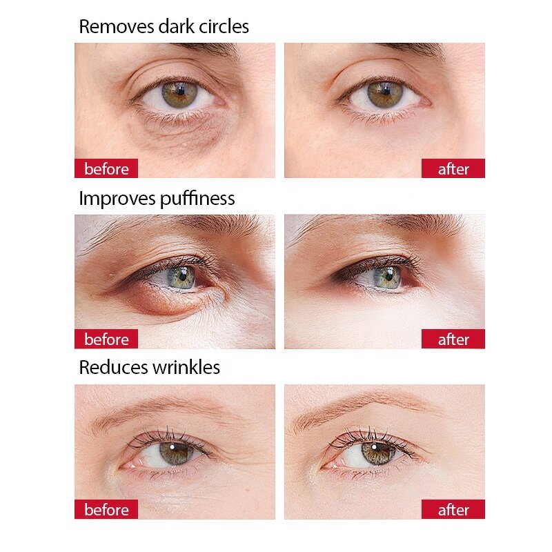 Eye Wrinkle Remover - Manufacturer - Instant Anti Dark Circles Under Eye Treatment Serum