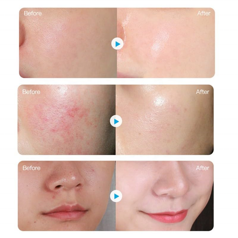 Vitamin C Facial Mask - Manufacturer - Deep Moisturizing Beauty Whitening Skin Care Mask