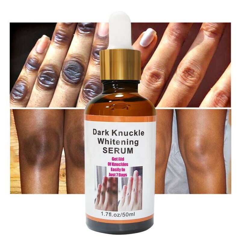 Dark Knuckle Serum - Manufacturer - OEM ODM Factory 7 Days Fast Whitening Spot Remover