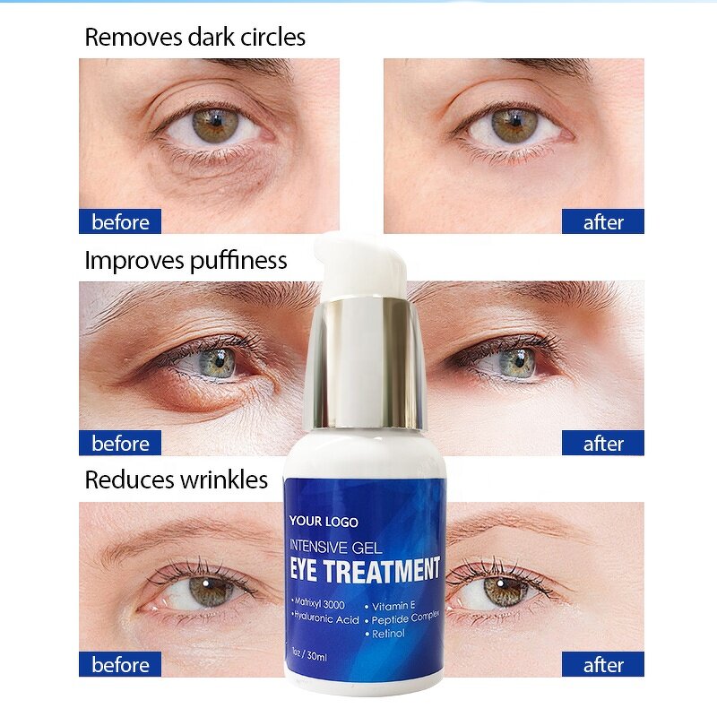 Retinol Eye Cream - Manufacturer - Private Label Vegan Anti Age Anti Wrinkle Dark Circles