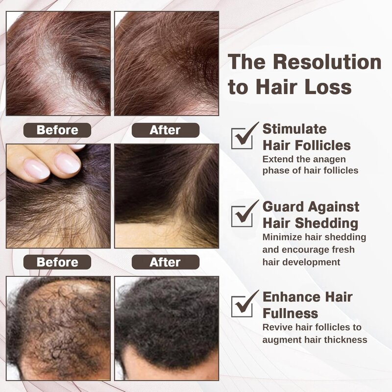 Ahk-Cu Hair Serum - Manufacturer - Oem Odm 5% Peptides Hair Growth Repair Anti Loss