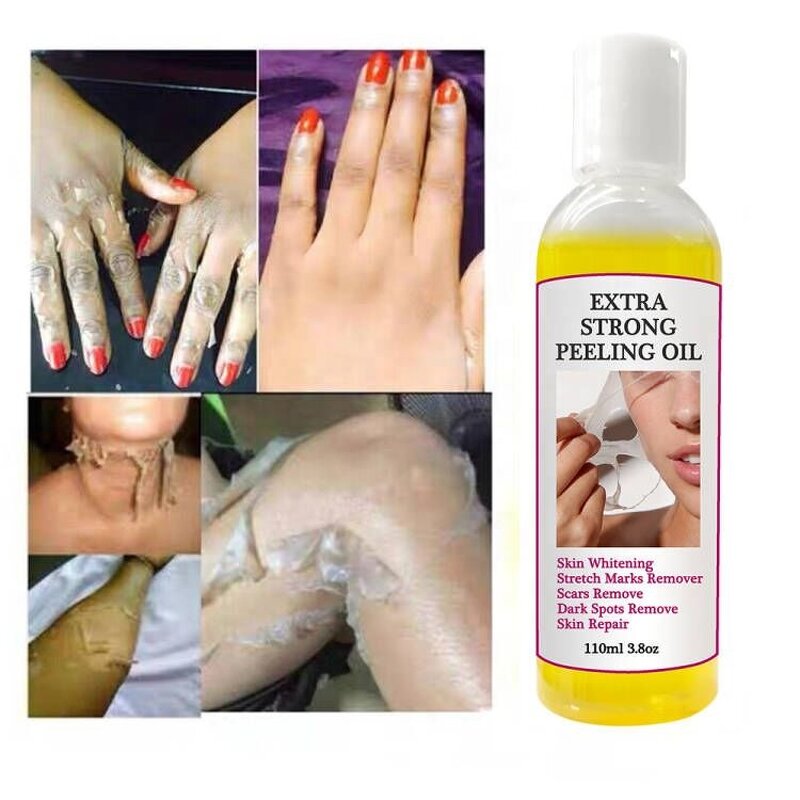 Peeling Oil - Manufacturer - Extra Strong Lighten Elbows Knees Melanin Dark Skin Bleaching