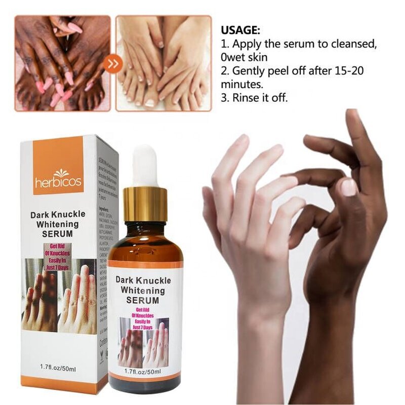 Yellow Peeling Oil - Manufacturer - OEM Super Strength Face Body Knees Hands Melanin Bleaching